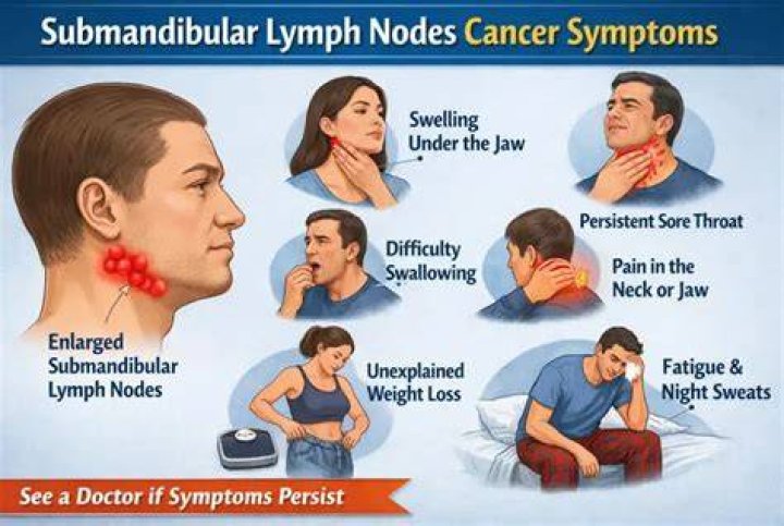 Is lymph node cancer curable?